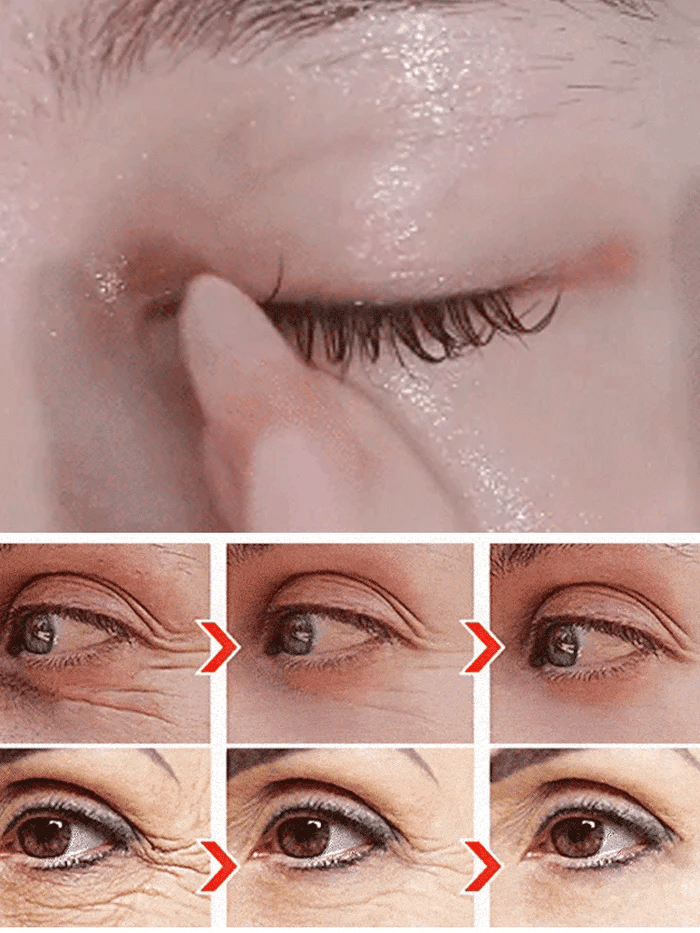 Anti-wrinkle eye serum oil